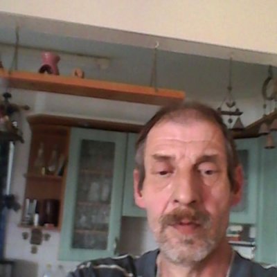 mir.hla